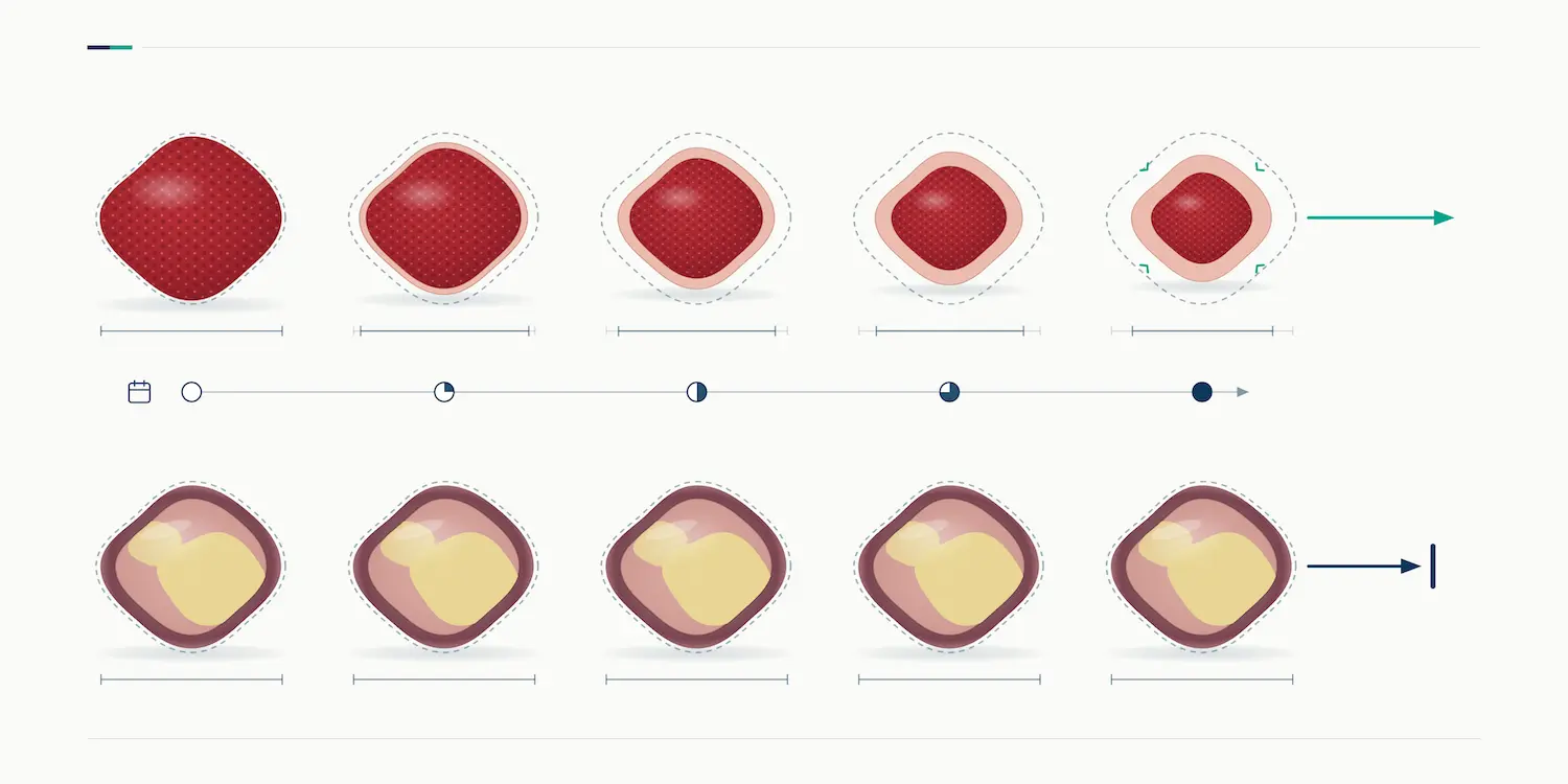 graphic showing a healing wound vs a stalled wound
